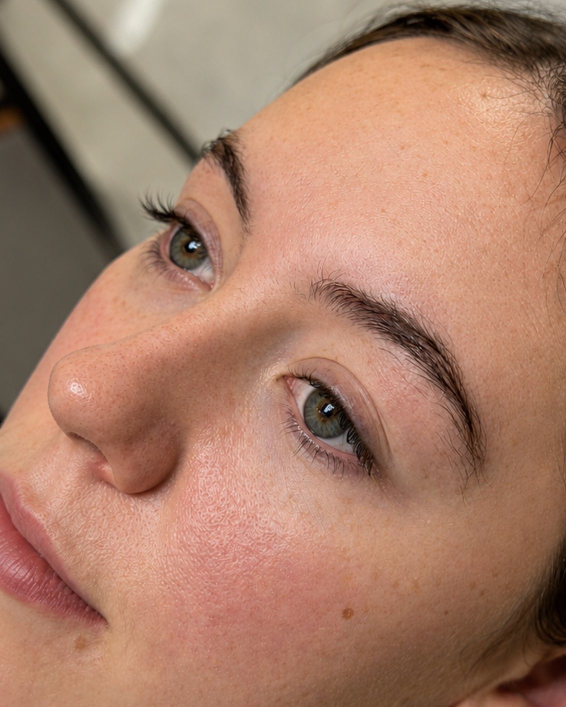 Before treatment